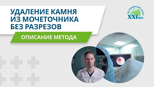 Удаление камня из мочеточника без разрезов